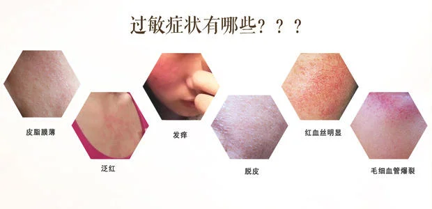 中美杜克